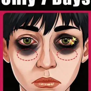 كريم مغذي سريع الامتصاص يزيل أكياس العين ويغذي البشرة