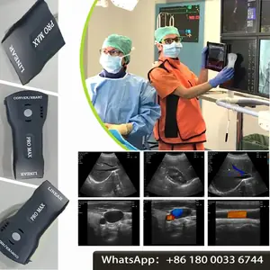 آلة الماسح الضوئي اللاسلكية المحمولة بالموجات فوق الصوتية WIFI آلة الماسح الضوئي بالموجات فوق الصوتية تدعم iOS Android Windows حقيبة مجانية